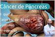 Câncer no pâncreas sintomas, causas, tratamento e cur
